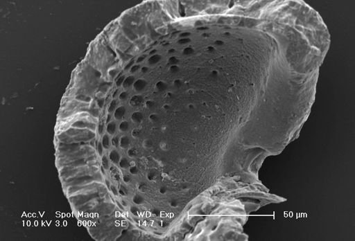 Neogloboquadrina dutertrei