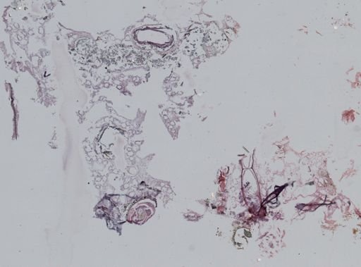 Hexactinellida