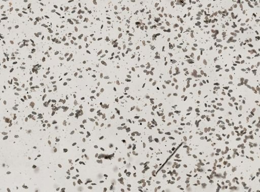 Holothuroidea