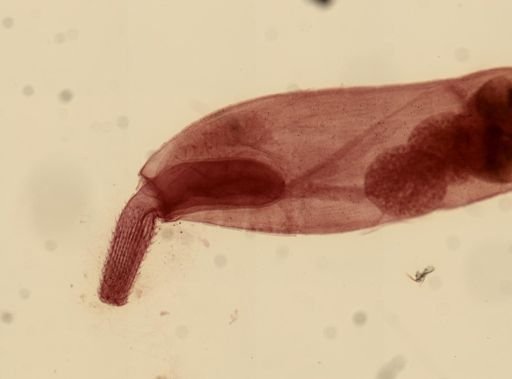 Echinorhynchus proteus
