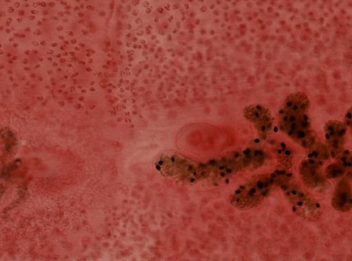 Diphyllobothrium latum