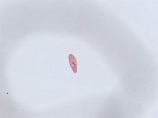 Paramecium aurelia