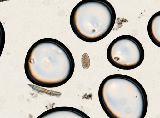 Fasciolopsis buski