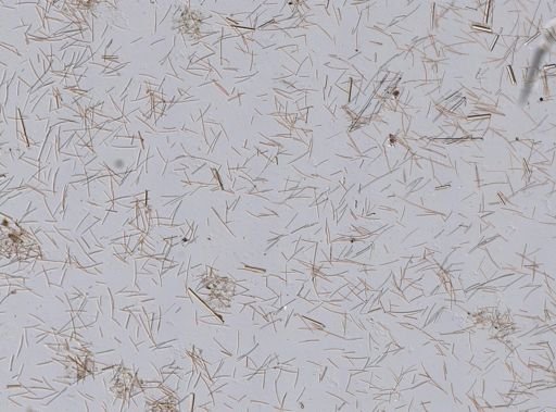 Haliclona (Soestella) caerulea