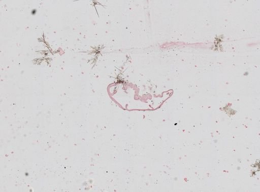 Nematostella