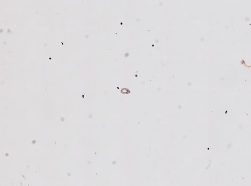 Protohydra leuckarti