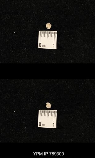 undet. Crinoidea