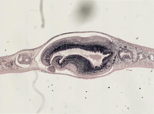 Turbellaria