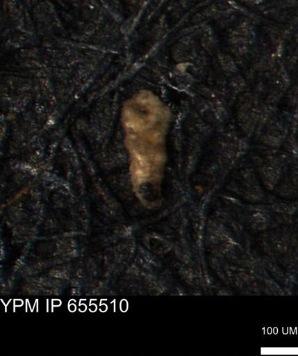 Verneuilina canadensis