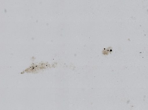 Rotifera