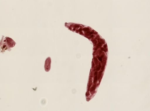 Fasciola hepatica