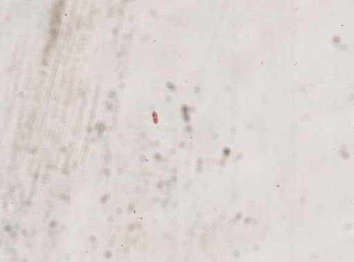 Paramecium