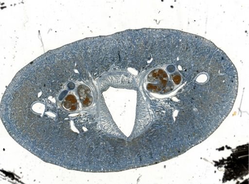 Erpobdella punctata