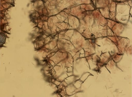 Isodictya deichmannae