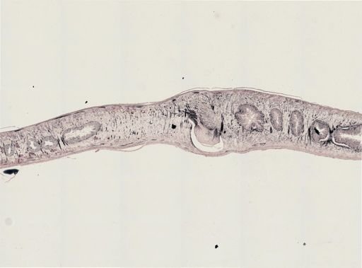 Turbellaria
