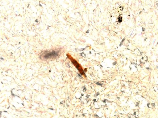 Trichocerca longiseta