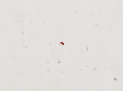 Trematoda