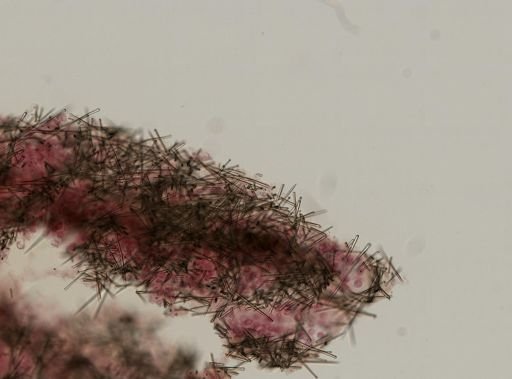 Suberites sp.