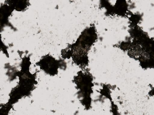 Trichuris trichiura