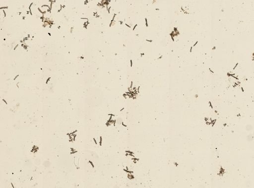 Holothuroidea