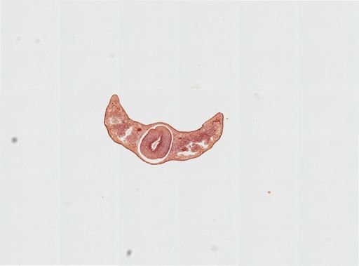 Foviella