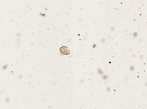 Paragonimus westermani