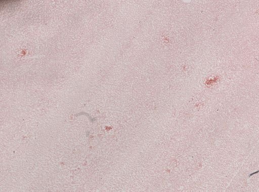 Plasmodium vivax
