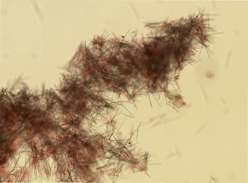 Halichondria bowerbanki