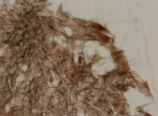 Ptilocaulis cf. walpersii