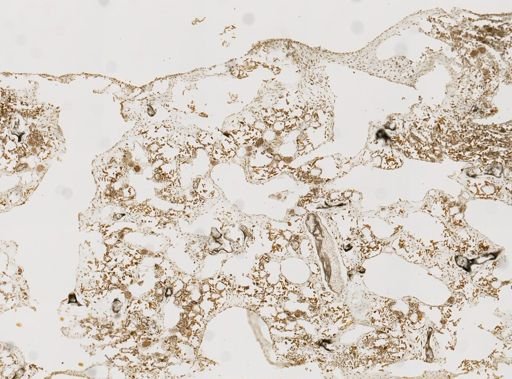 Dysidea sp.