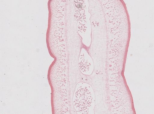 Taenia saginata