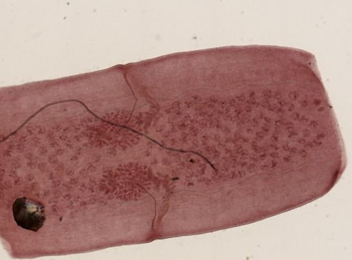 Dipylidium caninum