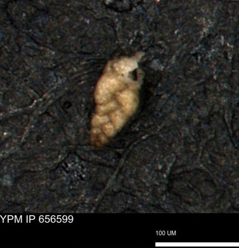 Verneuilina canadensis