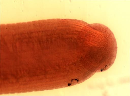 Erpobdella octoculata