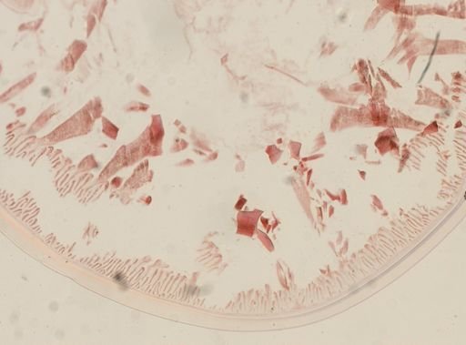 Ascaris megalocephala