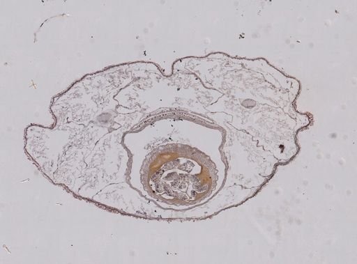 Plotonemertes adhaerens