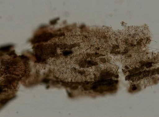 Microcionidae?