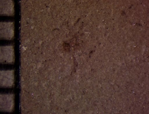 undet. Araneida