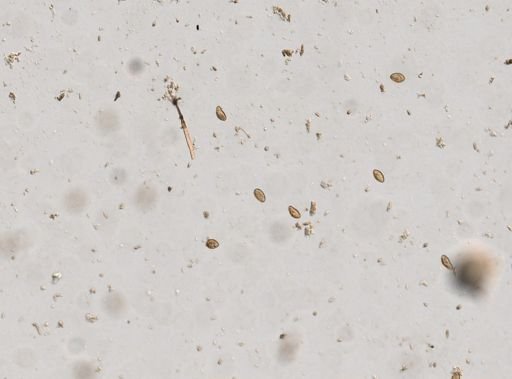 Diphyllobothrium canis