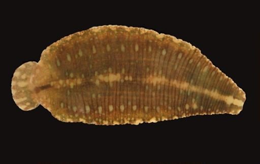 Hirudinea