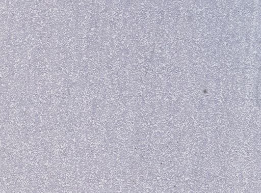 Leucocytozoon