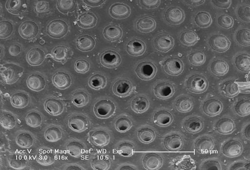 Sphaeroidinella dehiscens