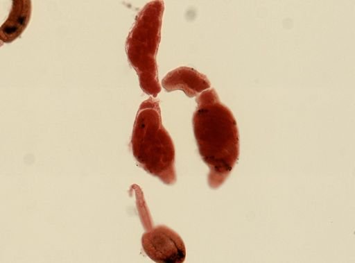 Digenea