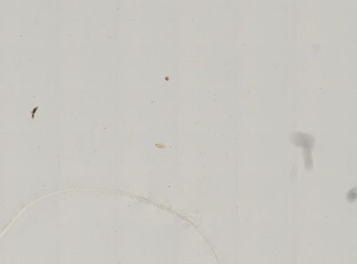 Paramecium