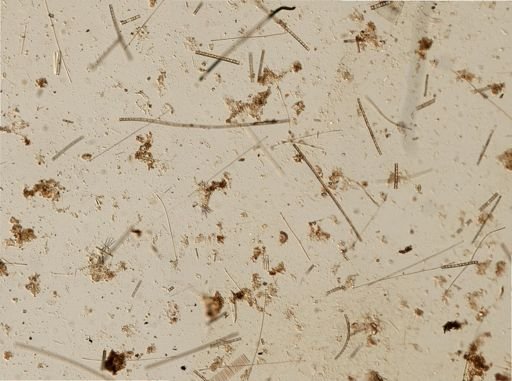Bacillariophyceae