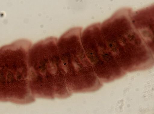Eucestoda