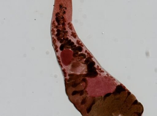 Haematoloechus medioplexus