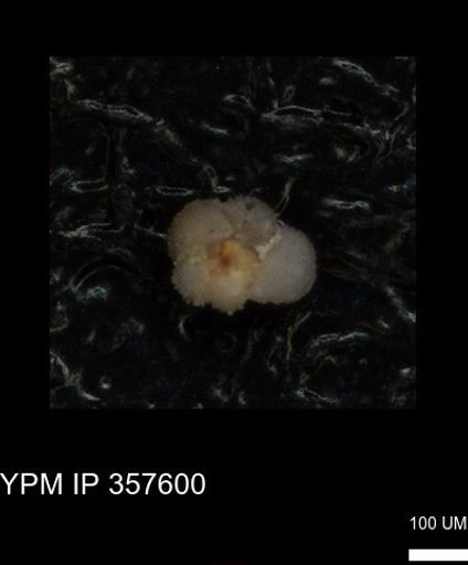 undet. Rugoglobigerinidae