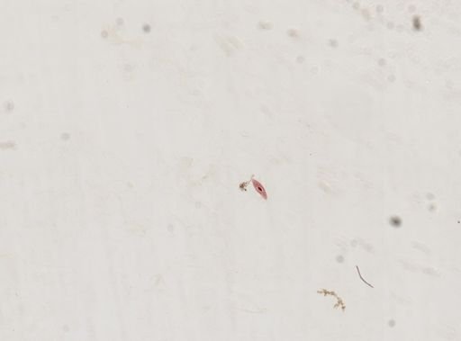 Paramecium