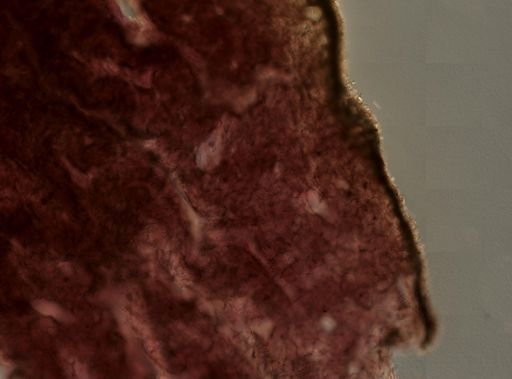 Plakortis sp.